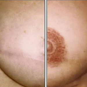 Areola-riew9n7tr7kynfrv5udtfmtrz2sjr44jvbod9fnf08
